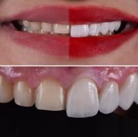 Family Implant and Reconstructive Dentistry image 5